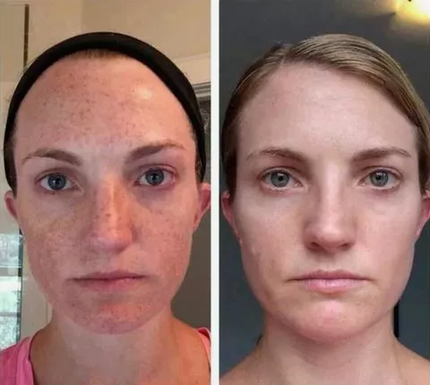 Turmeric-Dark-Spot-Corrector-Img1-min.webp