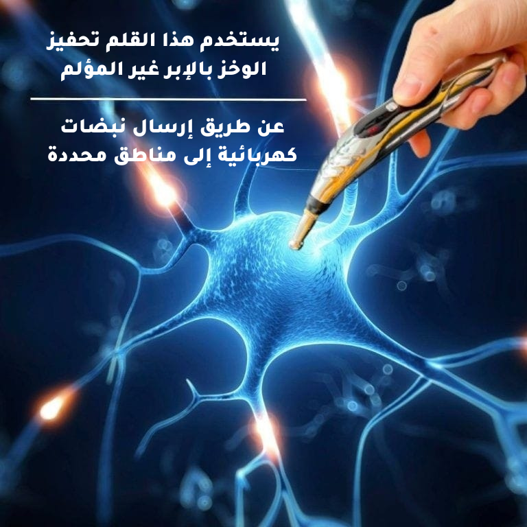 يستخدم هذا القلم تحفيز الوخز بالإبر غير المؤلم